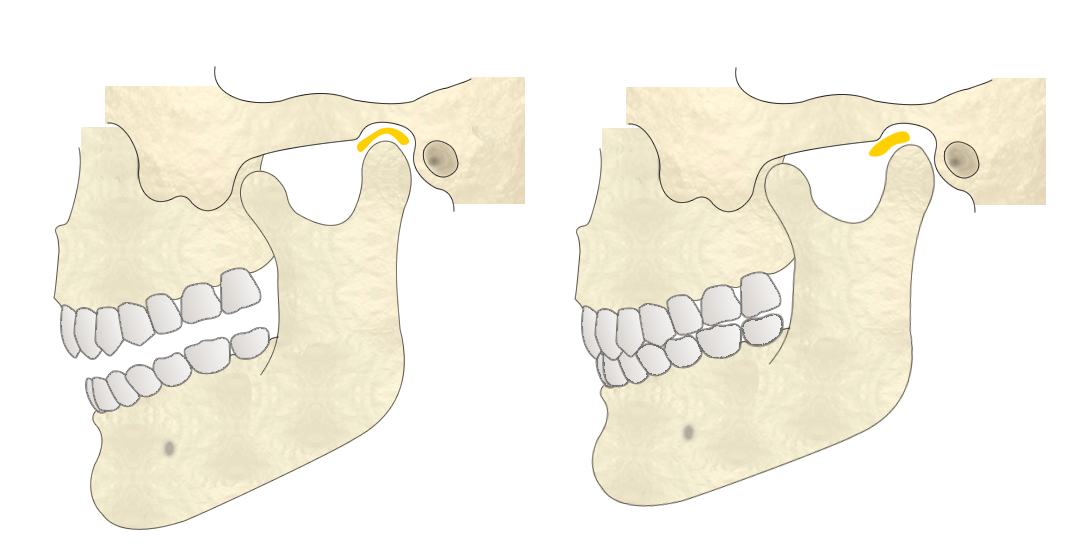 顎関節・いちファミリー歯科医院