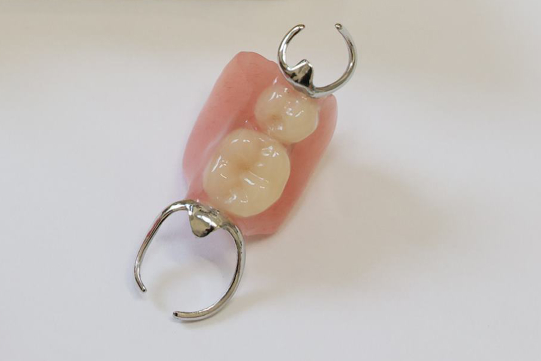 保険の入れ歯｜いちファミリー歯科医院