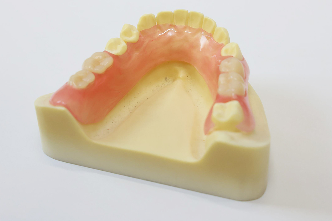 ノンスクラブデンチャー｜野田市のいちファミリー歯科医院