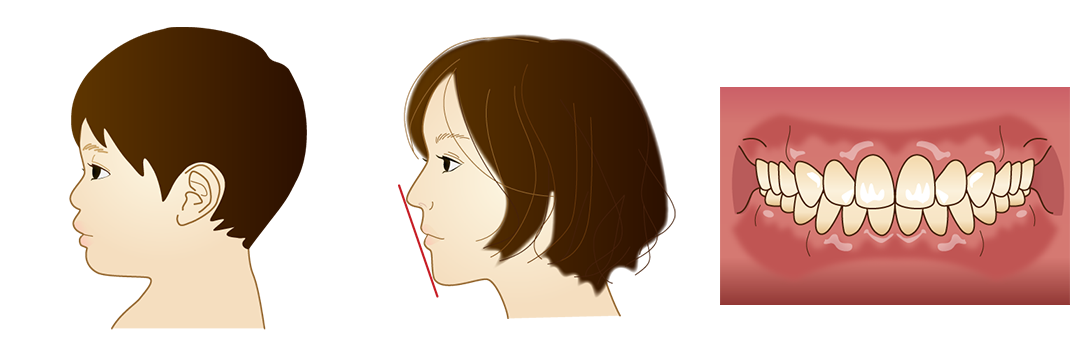 Eライン・矯正歯科｜いちファミリー歯科医院