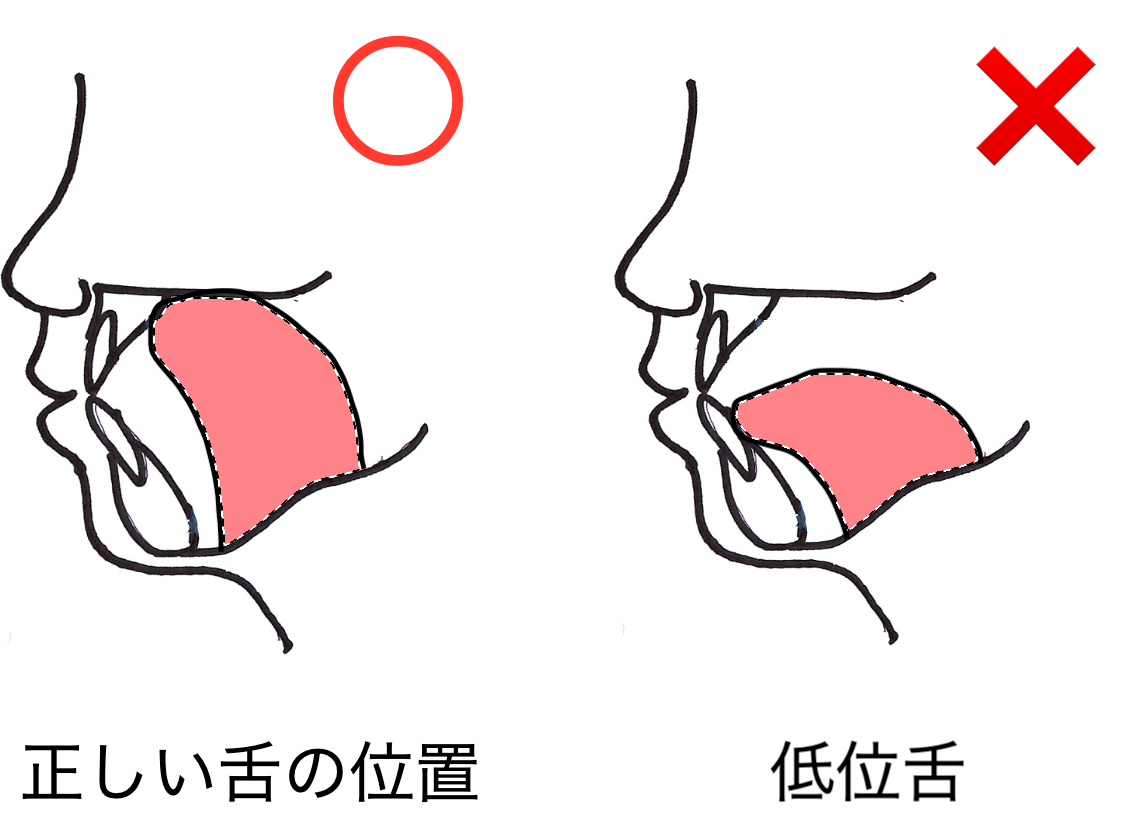 口の中の舌の一について｜いちファミリー歯科医院